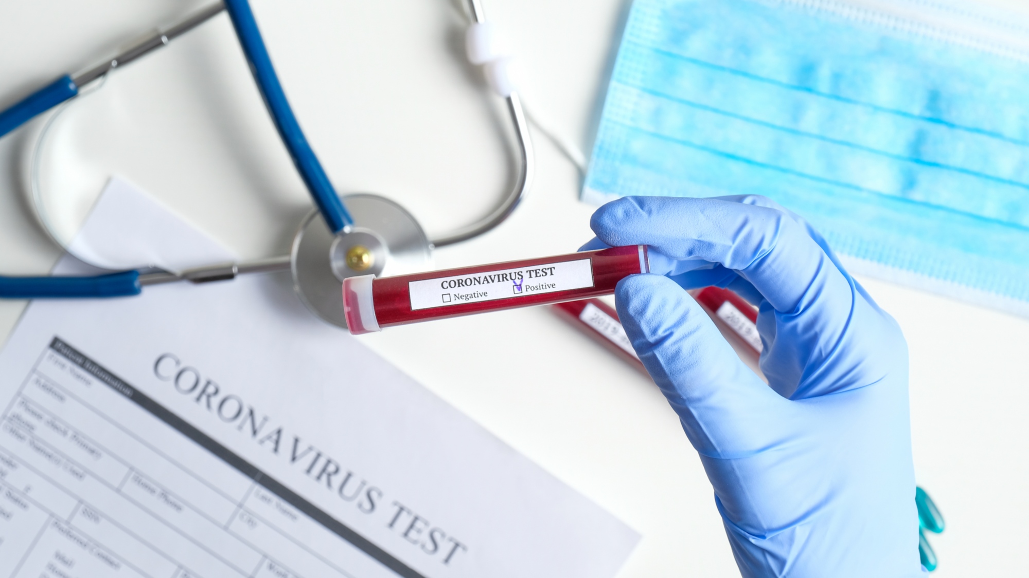 coronavirus-ottaviano-test-sierologici-studenti-annuncio-sindaco-capasso