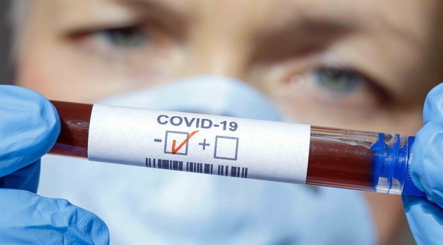 truffa-coronavirus-esami-sangue-napoli
