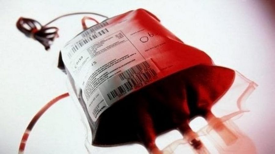 morta-trasfusione-sangue-infetto-napoli-risarcimento